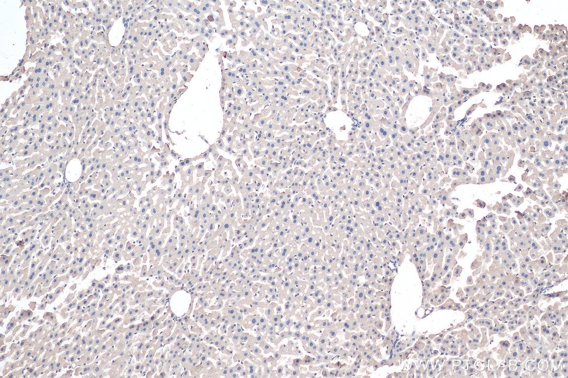 Immunohistochemistry (IHC) staining of mouse liver tissue using Aminomethyltransferase Polyclonal antibody (10633-1-AP)