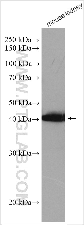 Western Blot (WB) analysis of various lysates using Aminomethyltransferase Polyclonal antibody (10633-1-AP)