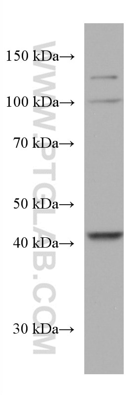Western Blot (WB) analysis of mouse liver tissue using AMT Monoclonal antibody (67532-1-Ig)