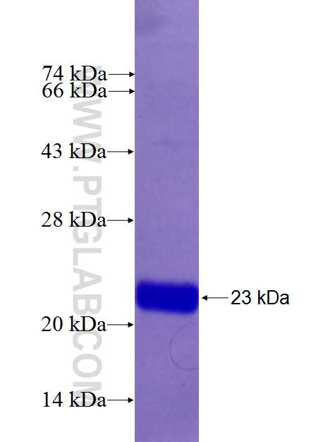 AMT fusion protein Ag26644 SDS-PAGE