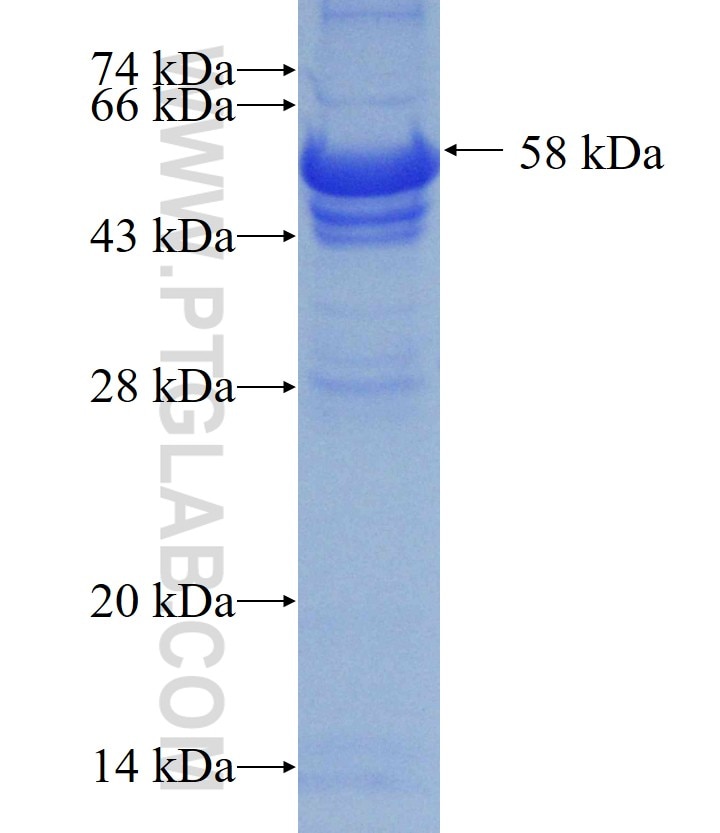 AMT fusion protein Ag0990 SDS-PAGE