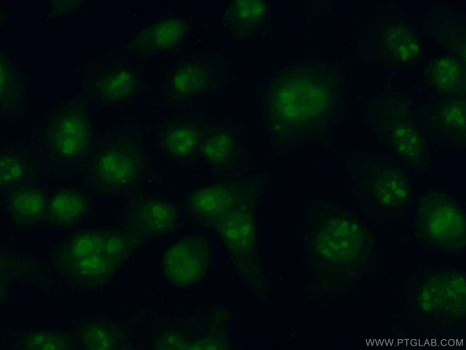 Immunofluorescence (IF) / fluorescent staining of A431 cells using AMTN Polyclonal antibody (24463-1-AP)