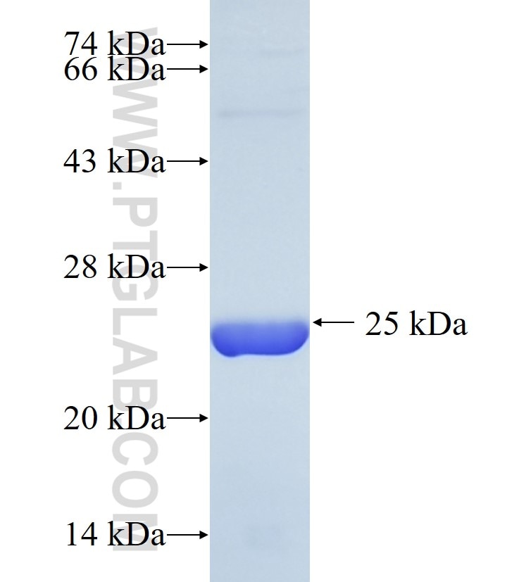AMTN fusion protein Ag36763 SDS-PAGE AMTN fusion protein Ag36763 SDS-PAGE