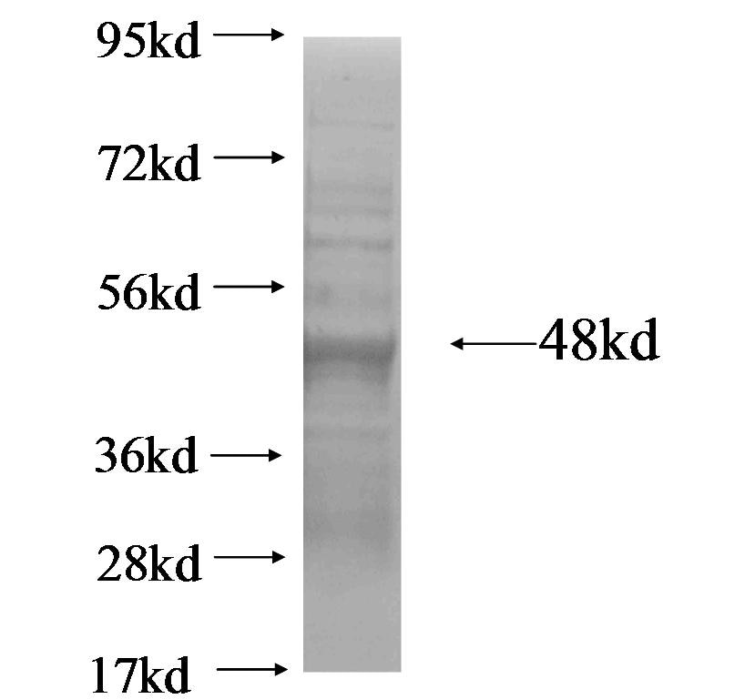 AMTN fusion protein Ag18439 SDS-PAGE