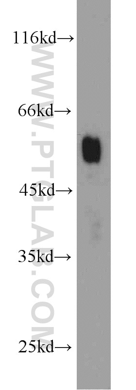Western Blot (WB) analysis of mouse pancreas tissue using Amylase Alpha Polyclonal antibody (15845-1-AP)