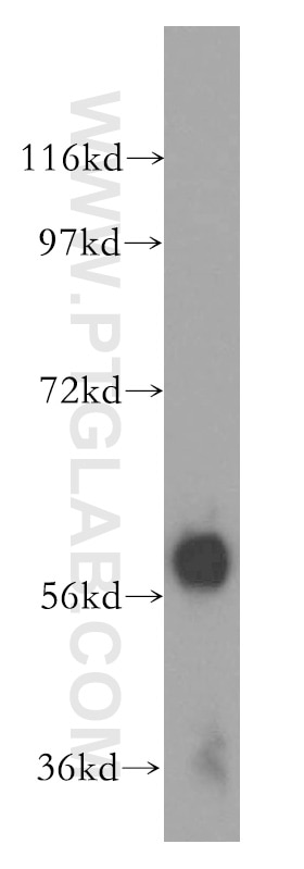 Western Blot (WB) analysis of human liver tissue using Amylase Alpha Polyclonal antibody (15845-1-AP)