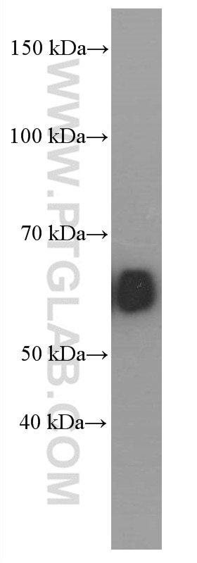 Western Blot (WB) analysis of human saliva using Amylase Alpha Monoclonal antibody (66133-1-Ig)