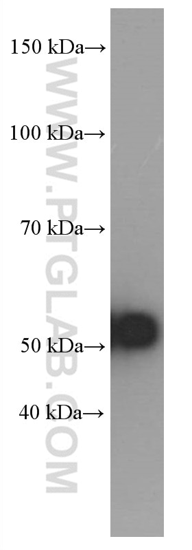 Western Blot (WB) analysis of pig pancreas tissue using Amylase Alpha Monoclonal antibody (66133-1-Ig)