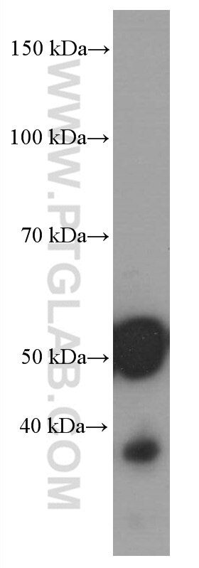 Western Blot (WB) analysis of rat pancreas tissue using Amylase Alpha Monoclonal antibody (66133-1-Ig)