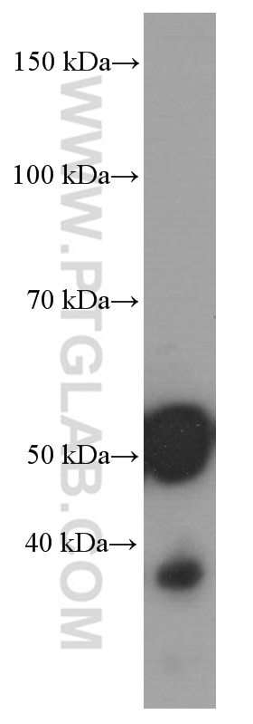 Western Blot (WB) analysis of rat pancreas tissue using Amylase Alpha Monoclonal antibody (66133-1-Ig)