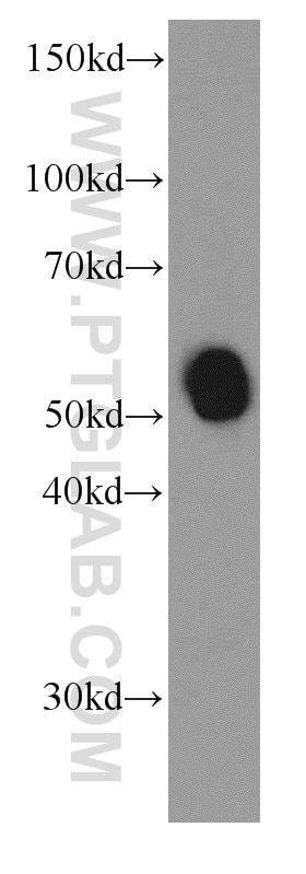 Western Blot (WB) analysis of human saliva using Amylase Alpha Monoclonal antibody (66133-1-Ig)