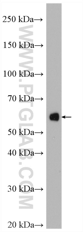 Western Blot (WB) analysis of mouse pancreas tissue using Amylase Alpha Polyclonal antibody (12540-1-AP)