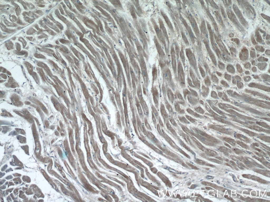 Immunohistochemistry (IHC) staining of human heart tissue using AMZ1 Polyclonal antibody (24484-1-AP)