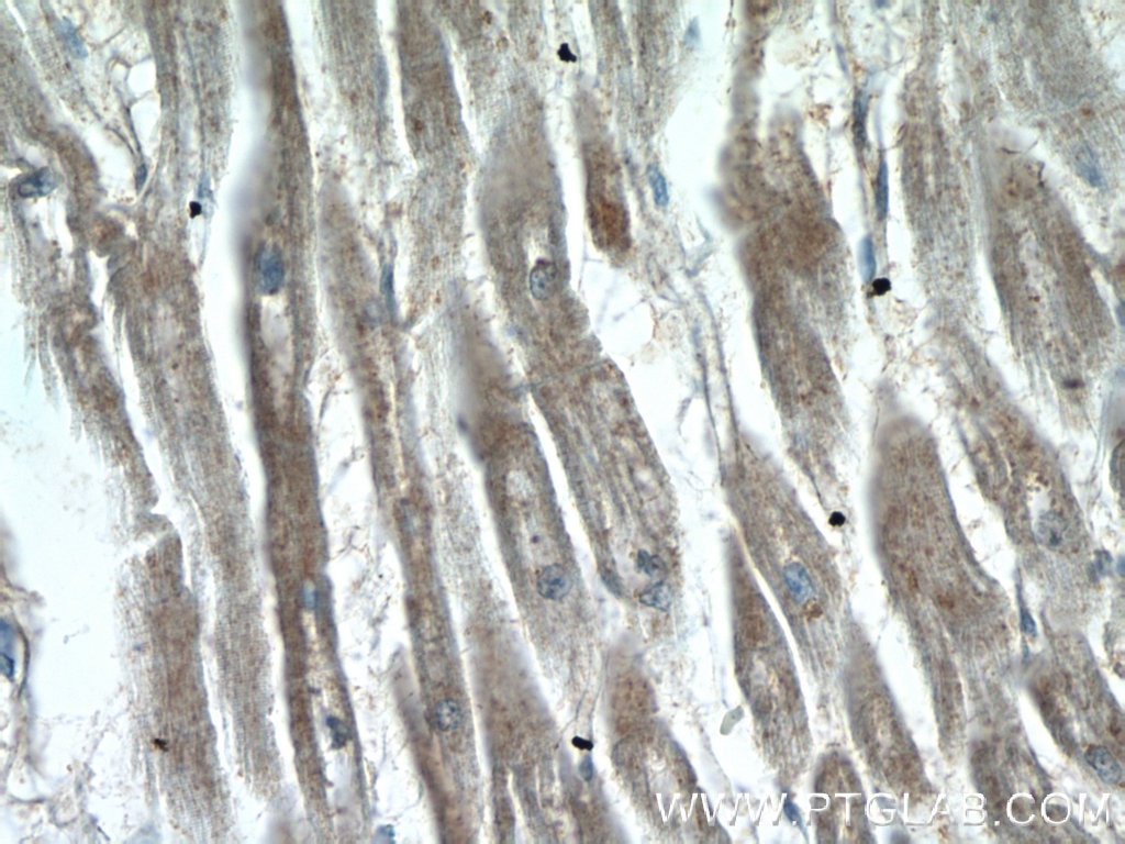 Immunohistochemistry (IHC) staining of human heart tissue using AMZ1 Polyclonal antibody (24484-1-AP)