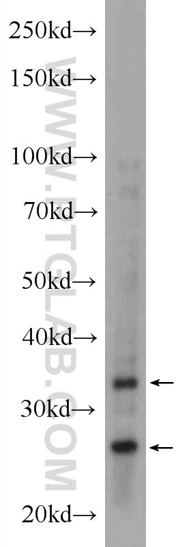 Western Blot (WB) analysis of mouse brain tissue using AMZ1 Polyclonal antibody (24484-1-AP)