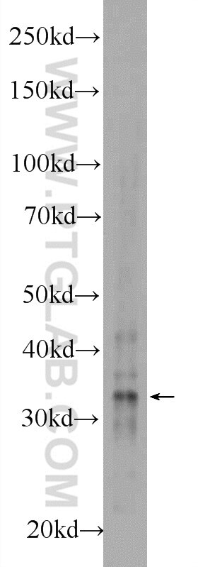 WB analysis of mouse liver using 24484-1-AP