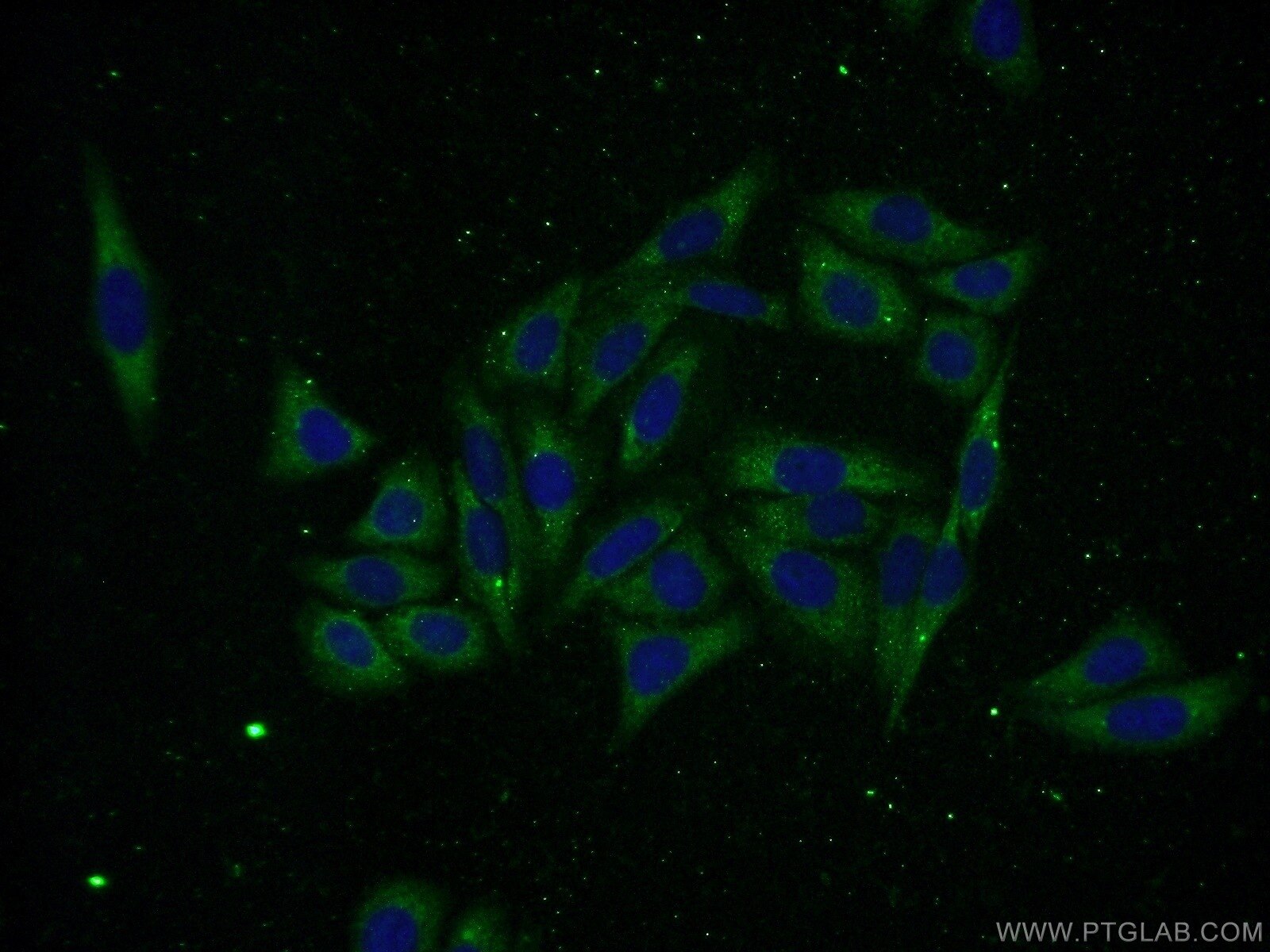 Immunofluorescence (IF) / fluorescent staining of HepG2 cells using AMZ2 Polyclonal antibody (16664-1-AP)