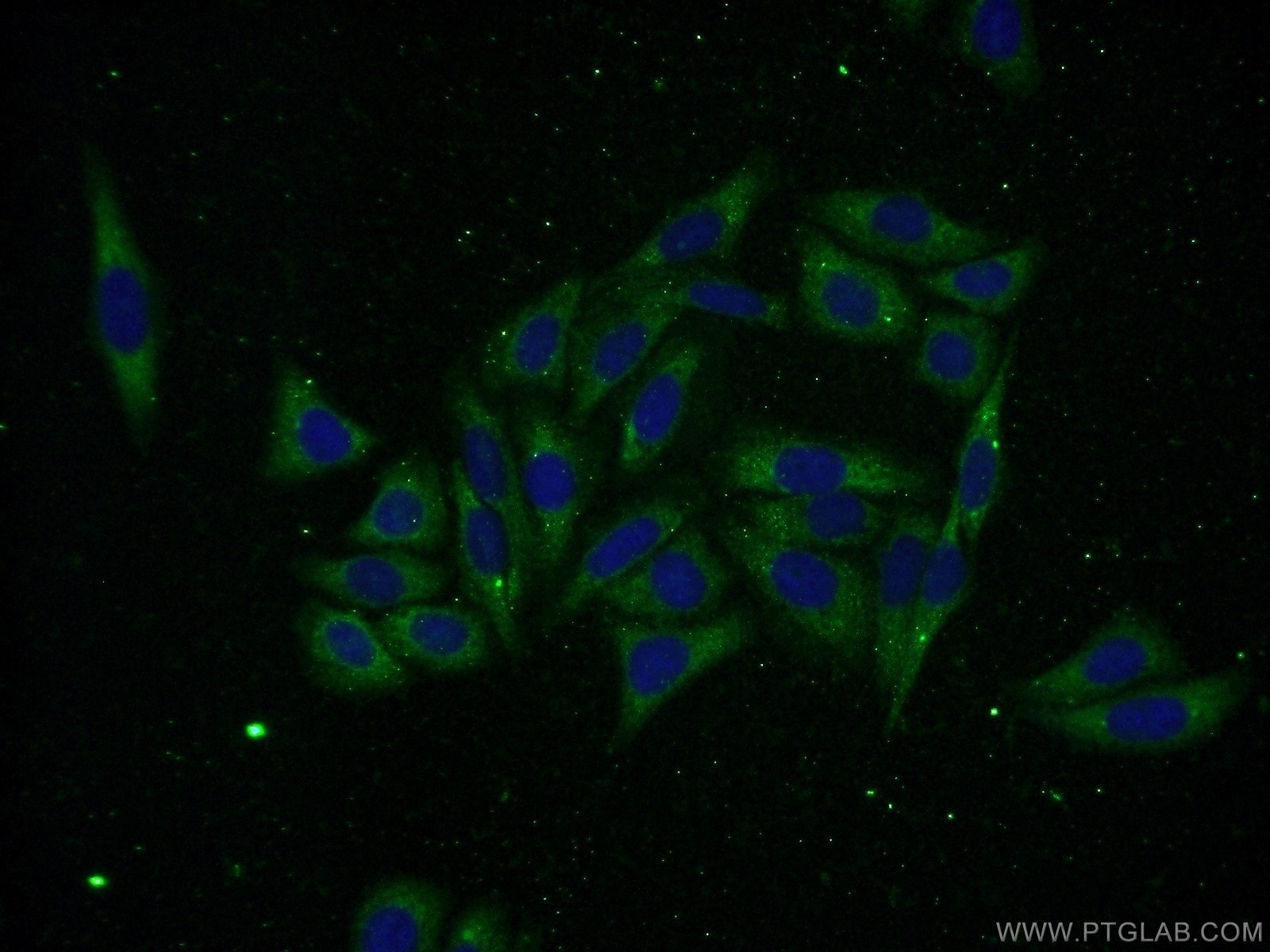 IF Staining of HepG2 using 16664-1-AP