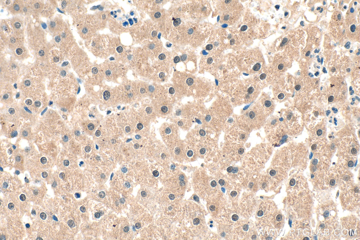 Immunohistochemistry (IHC) staining of human liver tissue using AMZ2 Polyclonal antibody (16664-1-AP)