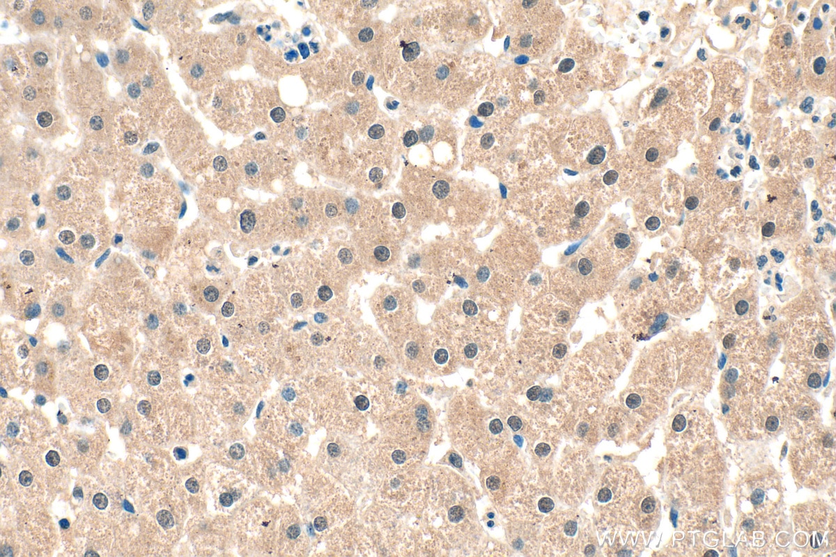 IHC staining of human liver using 16664-1-AP