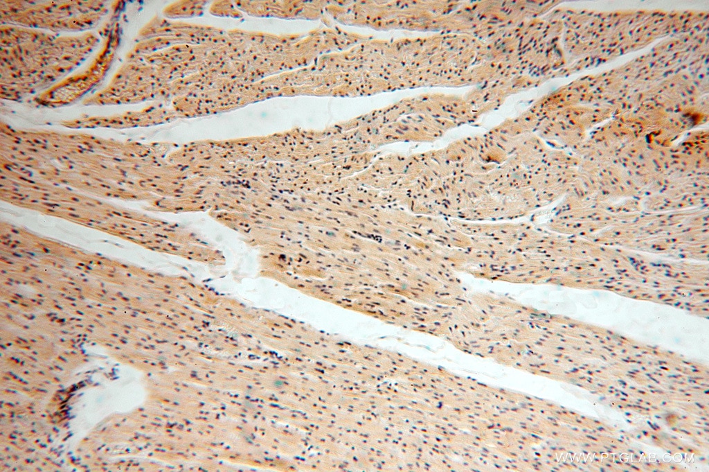 IHC staining of human heart using 16664-1-AP