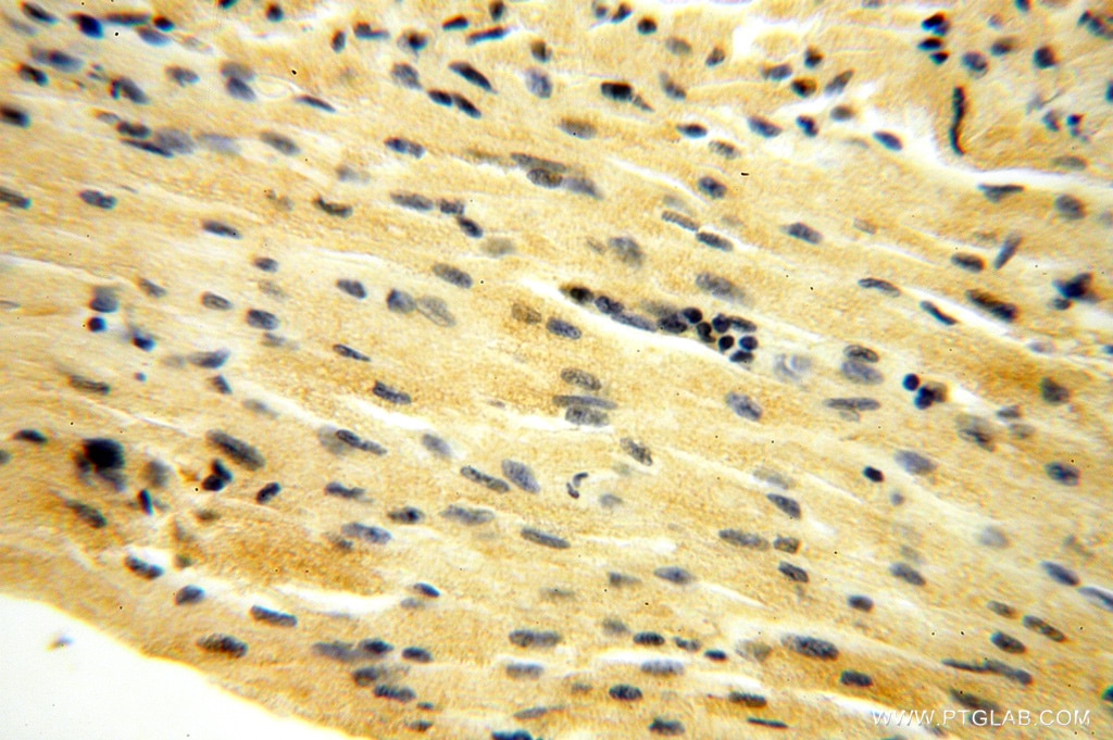 Immunohistochemistry (IHC) staining of human heart tissue using AMZ2 Polyclonal antibody (16664-1-AP)