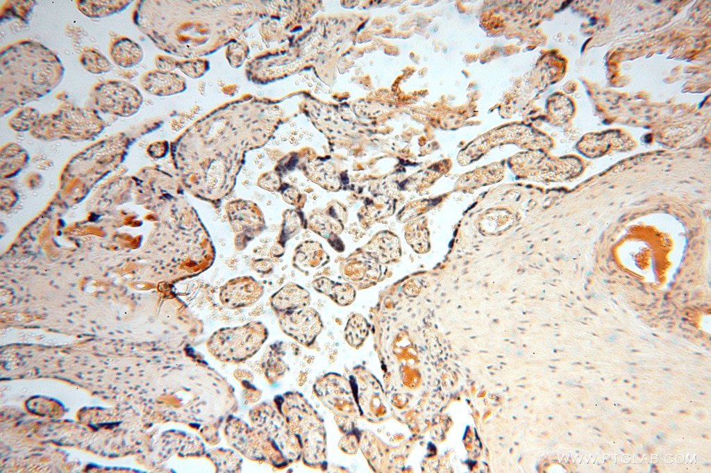 Immunohistochemistry (IHC) staining of human placenta tissue using AMZ2 Polyclonal antibody (16664-1-AP)