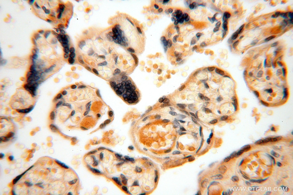 Immunohistochemistry (IHC) staining of human placenta tissue using AMZ2 Polyclonal antibody (16664-1-AP)