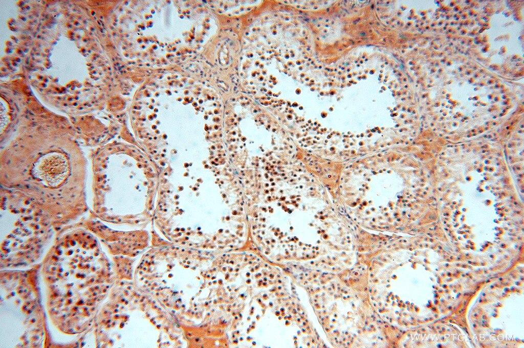 Immunohistochemistry (IHC) staining of human testis tissue using AMZ2 Polyclonal antibody (16664-1-AP)