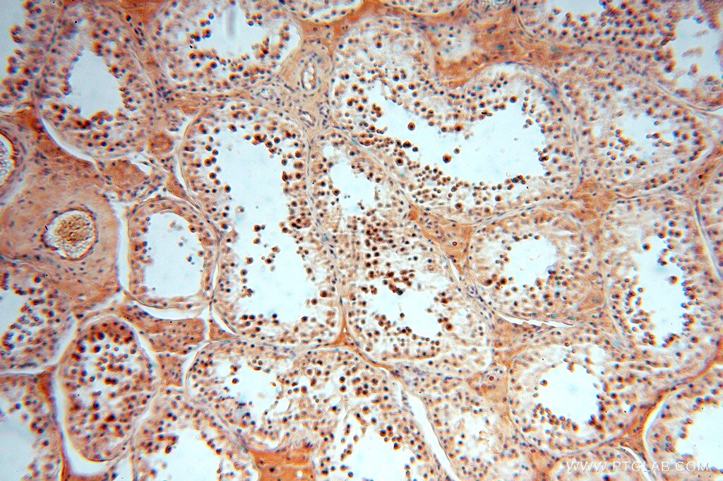 IHC staining of human testis using 16664-1-AP