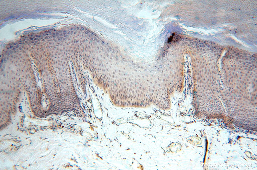 Immunohistochemistry (IHC) staining of human skin tissue using AMZ2 Polyclonal antibody (16664-1-AP)