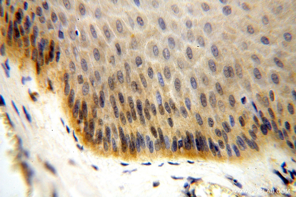 IHC staining of human skin using 16664-1-AP