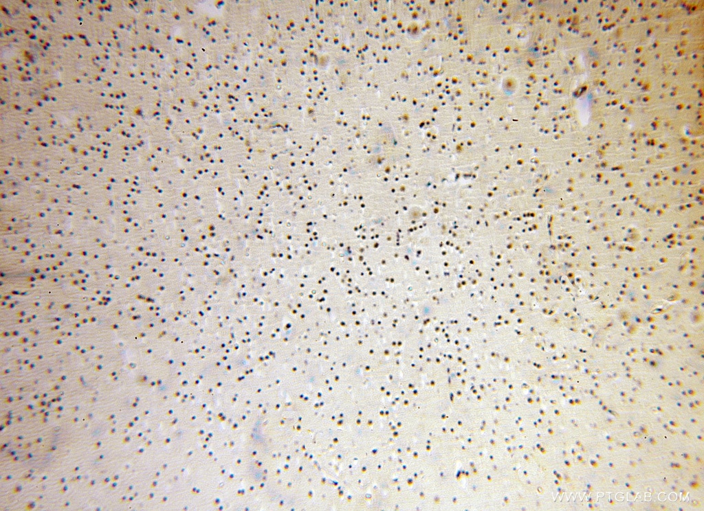 Immunohistochemistry (IHC) staining of human brain tissue using AMZ2 Polyclonal antibody (16664-1-AP)