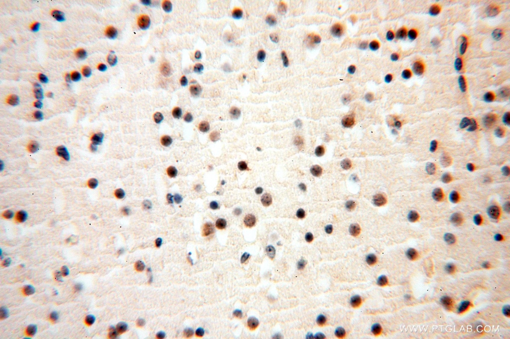 Immunohistochemistry (IHC) staining of human brain tissue using AMZ2 Polyclonal antibody (16664-1-AP)