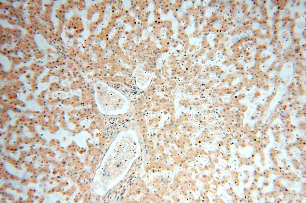 Immunohistochemistry (IHC) staining of human liver tissue using AMZ2 Polyclonal antibody (16664-1-AP)