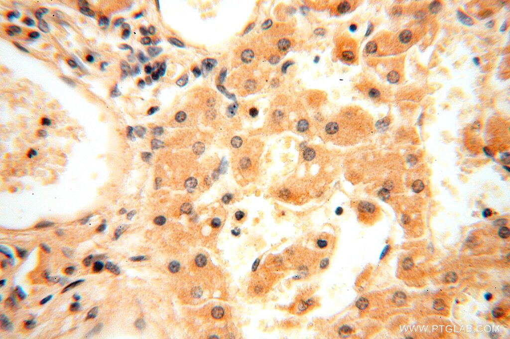 IHC staining of human liver using 16664-1-AP