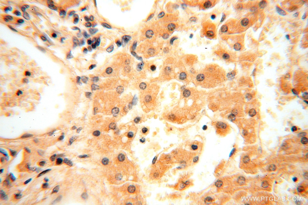 Immunohistochemistry (IHC) staining of human liver tissue using AMZ2 Polyclonal antibody (16664-1-AP)