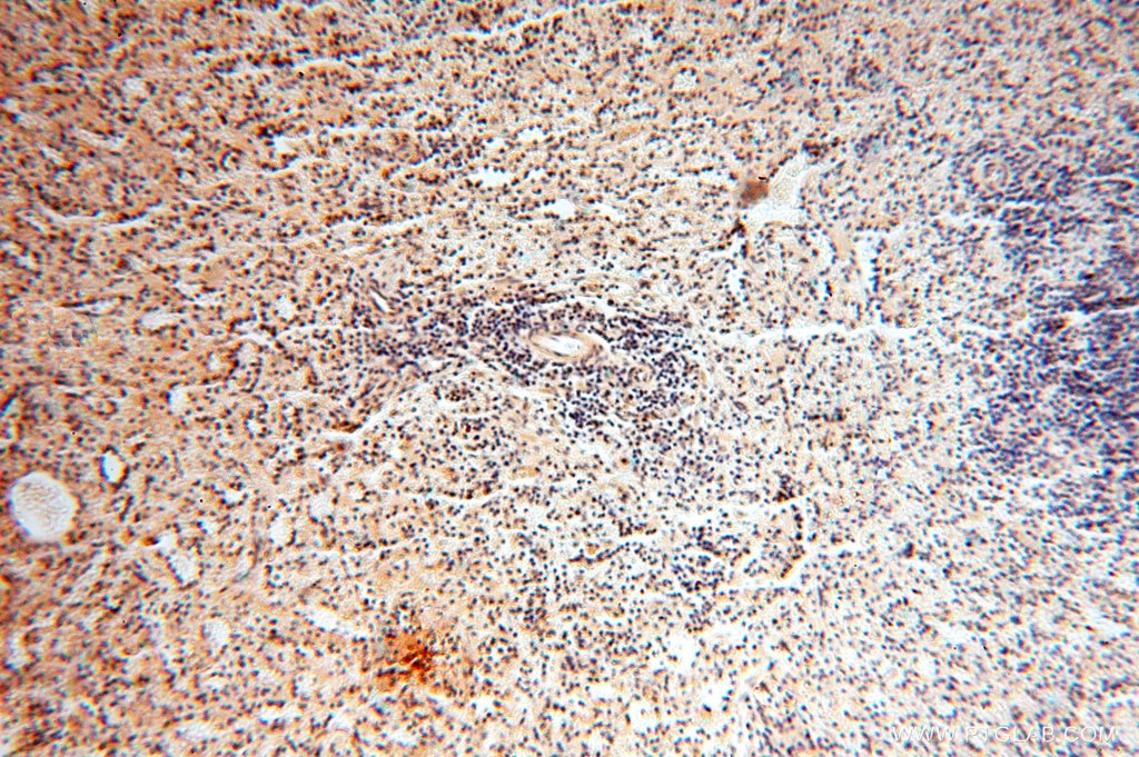 Immunohistochemistry (IHC) staining of human spleen tissue using AMZ2 Polyclonal antibody (16664-1-AP)