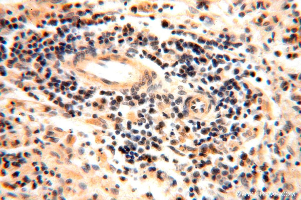 Immunohistochemistry (IHC) staining of human spleen tissue using AMZ2 Polyclonal antibody (16664-1-AP)