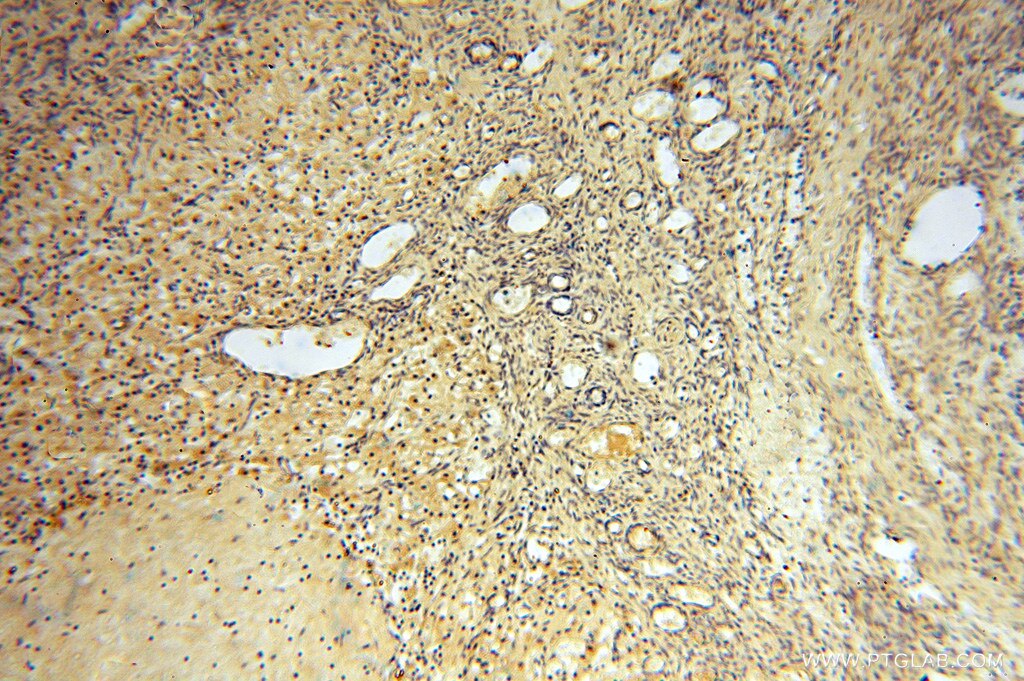 Immunohistochemistry (IHC) staining of human ovary tissue using AMZ2 Polyclonal antibody (16664-1-AP)