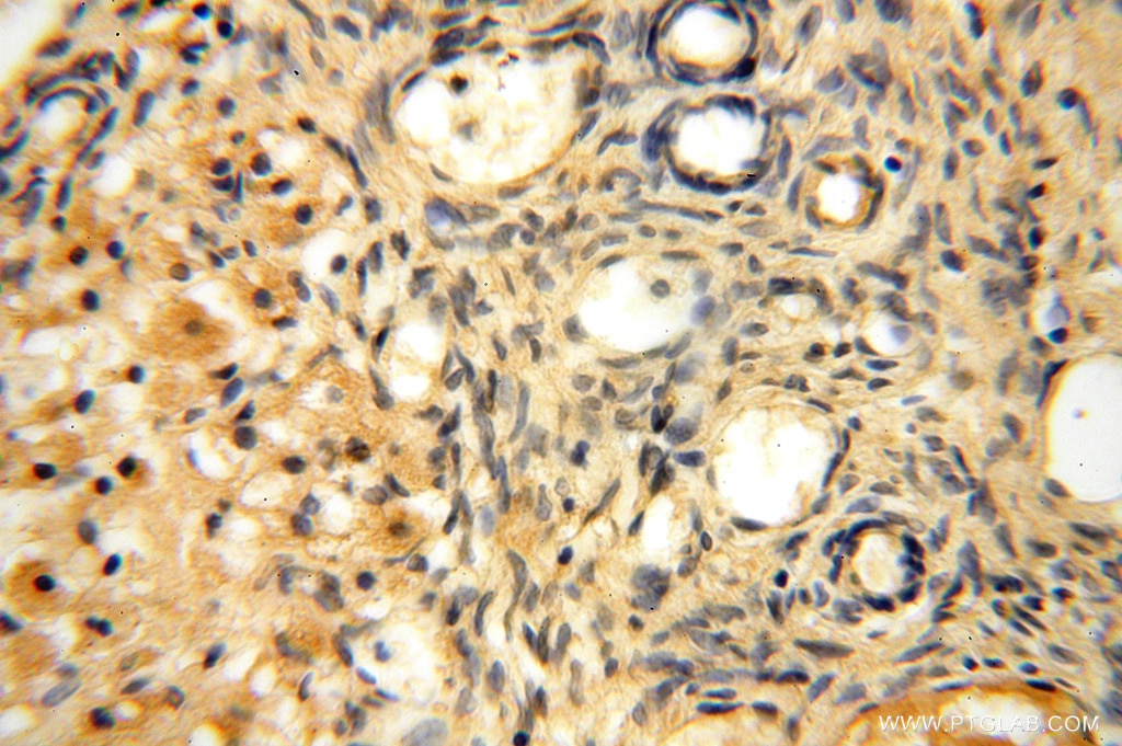 Immunohistochemistry (IHC) staining of human ovary tissue using AMZ2 Polyclonal antibody (16664-1-AP)