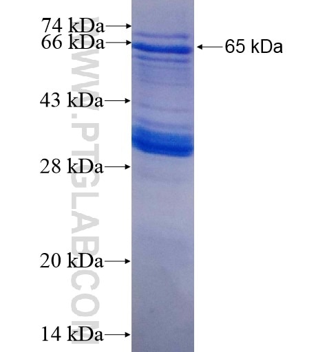 AMZ2 fusion protein Ag10141 SDS-PAGE