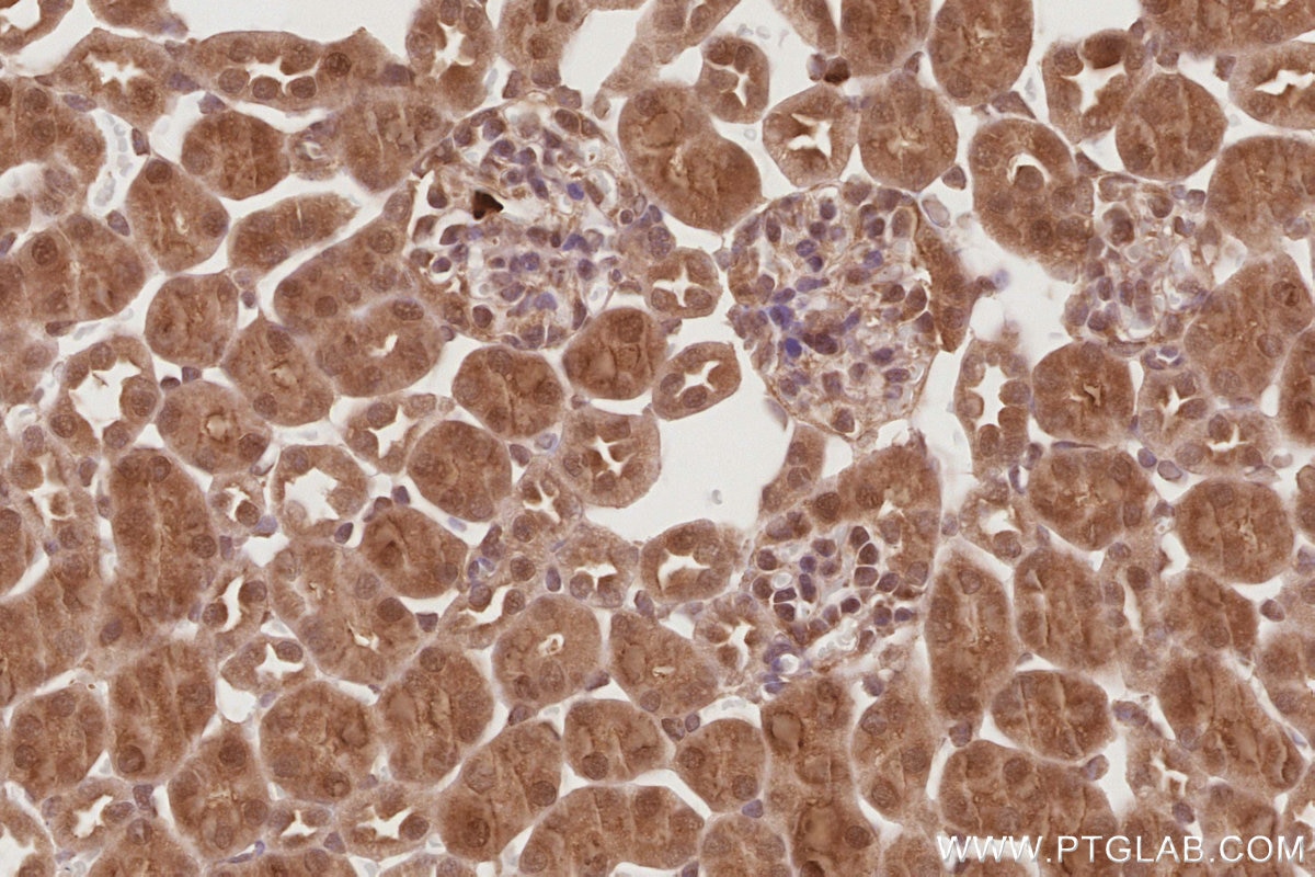 IHC staining of mouse kidney using 21748-1-AP Immunohistochemistry (IHC) staining of mouse kidney tissue using APC1 Polyclonal antibody (21748-1-AP)