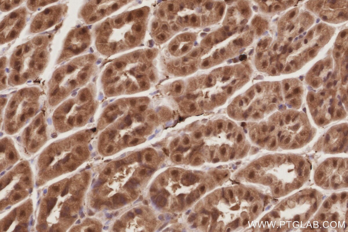 IHC staining of mouse stomach using 21748-1-AP Immunohistochemistry (IHC) staining of mouse stomach tissue using APC1 Polyclonal antibody (21748-1-AP)