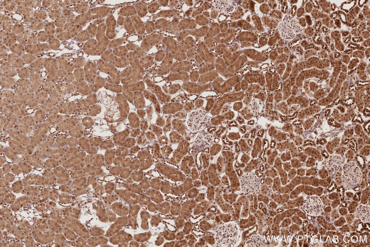 IHC staining of rat kidney using 21748-1-AP Immunohistochemistry (IHC) staining of rat kidney tissue using APC1 Polyclonal antibody (21748-1-AP)