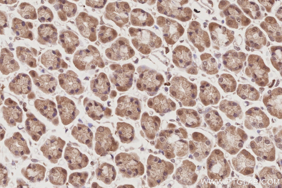 IHC staining of rat stomach using 21748-1-AP Immunohistochemistry (IHC) staining of rat stomach tissue using APC1 Polyclonal antibody (21748-1-AP)