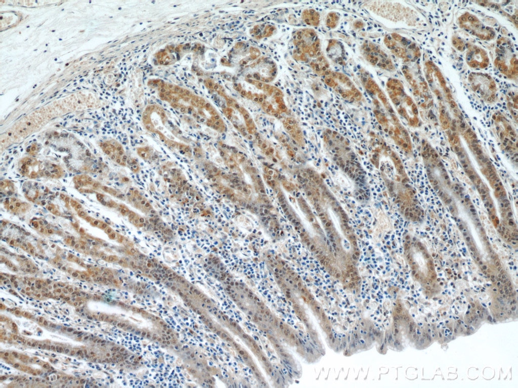 Immunohistochemistry (IHC) staining of human stomach tissue using APC1 Polyclonal antibody (21748-1-AP)