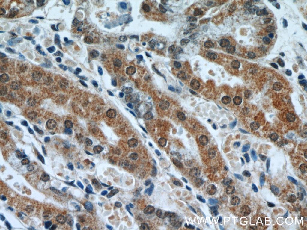 IHC staining of human stomach using 21748-1-AP