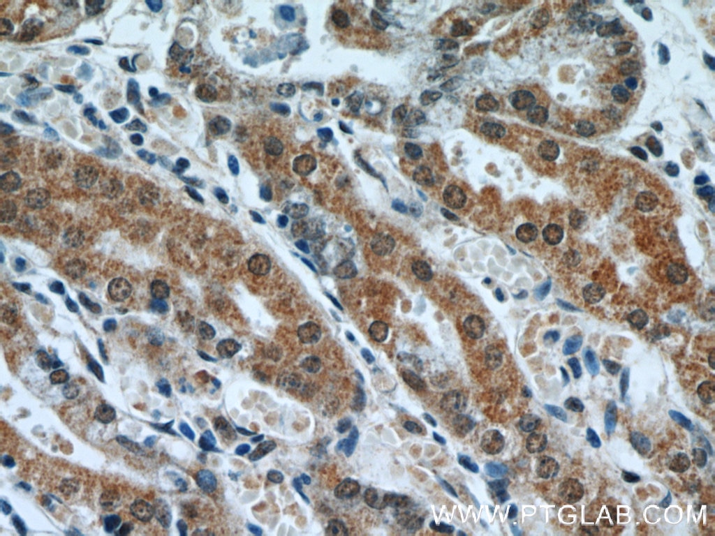 Immunohistochemistry (IHC) staining of human stomach tissue using APC1 Polyclonal antibody (21748-1-AP)