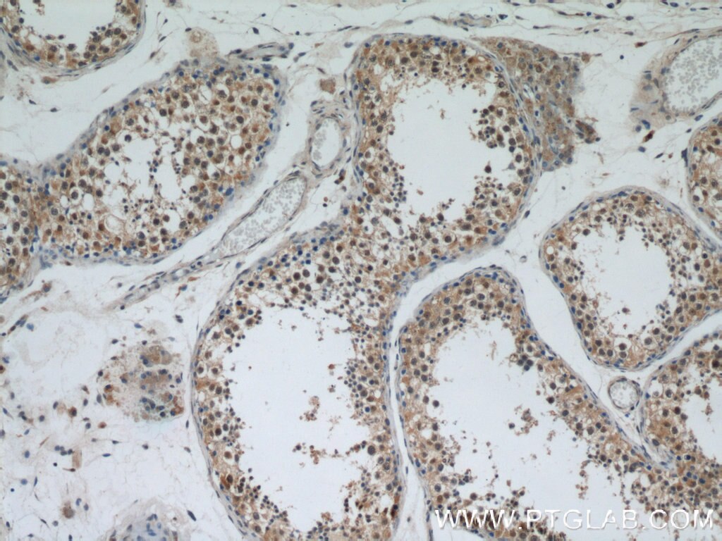 Immunohistochemistry (IHC) staining of human testis tissue using APC1 Polyclonal antibody (21748-1-AP)